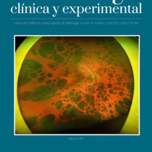 Flor de problema: angiografía por tomografía de coherencia óptica en diabetes
