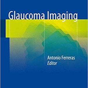 Glaucoma imaging.jpg