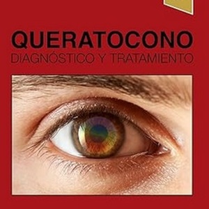 Queratocono diagnostico y tratamiento.jpg