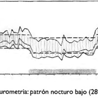 Fig. 12. Caso 3. Presurometria: patrón nocturno bajo (28%) y diurno normal.
