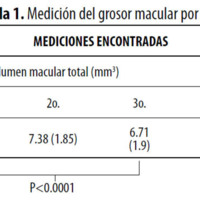 Tabla 1. Medición del grosor macular por OCT.