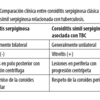 Tabla 1. Comparación clínica entre coroiditis serpiginosa clásica y coroiditis símil serpiginosa relacionada con tuberculosis.